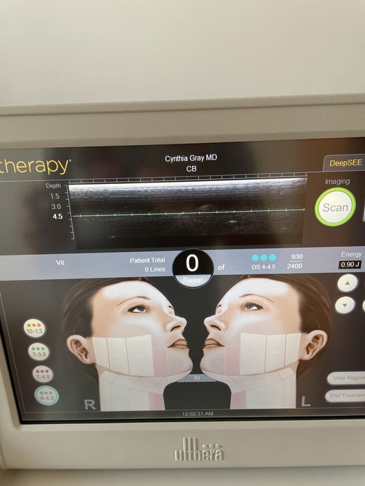 Ulthera System Альтера (original) USA аренда 18000 грн