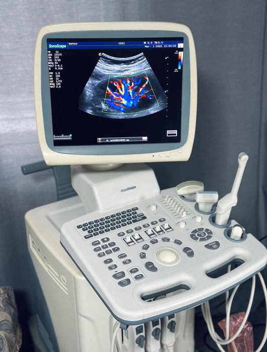 УЗД/УЗИ апарат Sonoscape SSI-6000 /3х датчики