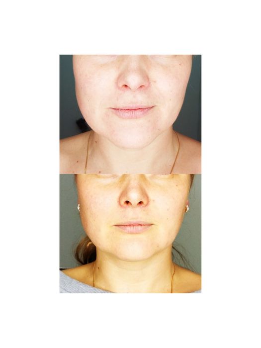 Масаж,Масаж обличчя,Антицелюлітний масаж,Пресотерапія,Styx обгортання