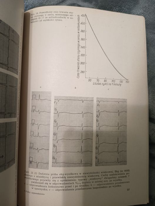 Próby czynnościowe w elektrokardiograficznej diagnostyce choroby wieńc