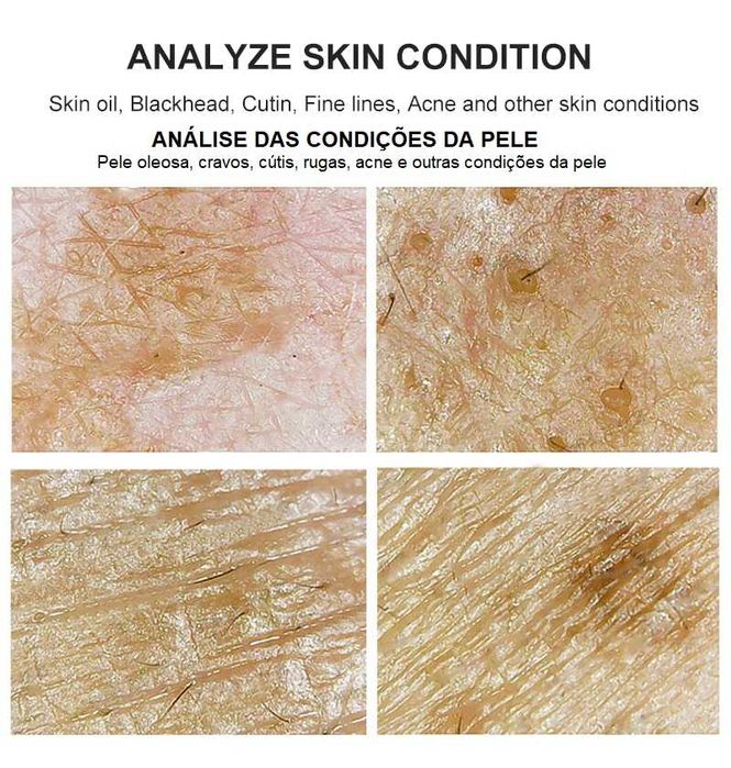 Máquina de Análise do Cabelo e da Pele (NOVA E PROFISSIONAL)