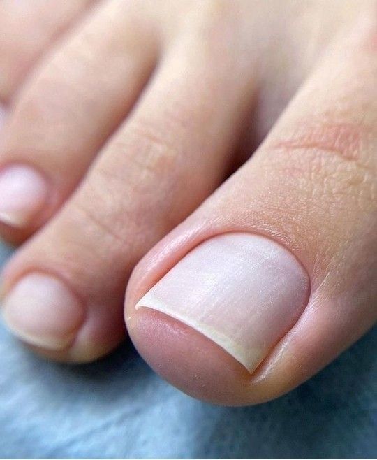 Педикюр Николаев.Чистые пятки без лезвия.600 грн.Стерильно