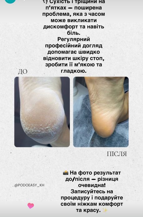 Послуги подолога, естетичний манікюр ХТЗ