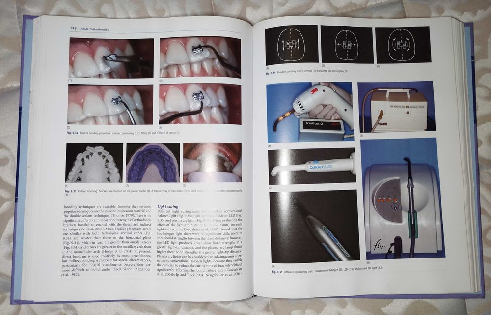 Livro Adult Orthodontics de Birte Melsen - 1ª Edição