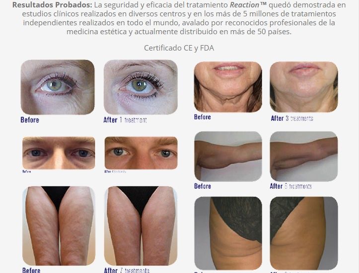 VIORA Radiofrequência corporal e facial (Viora Medical)