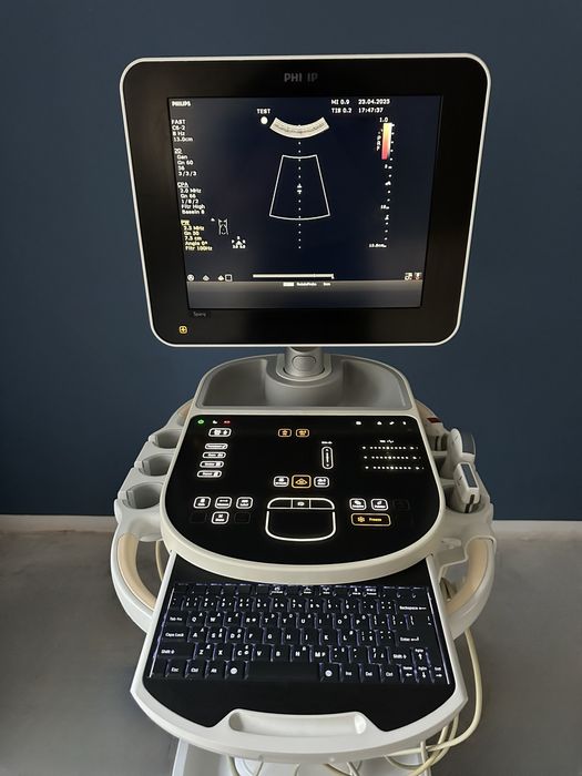 Ультразвуковий апарат Philips Sparq 2014р 3 датчика, УЗИ УЗД КАРДІО