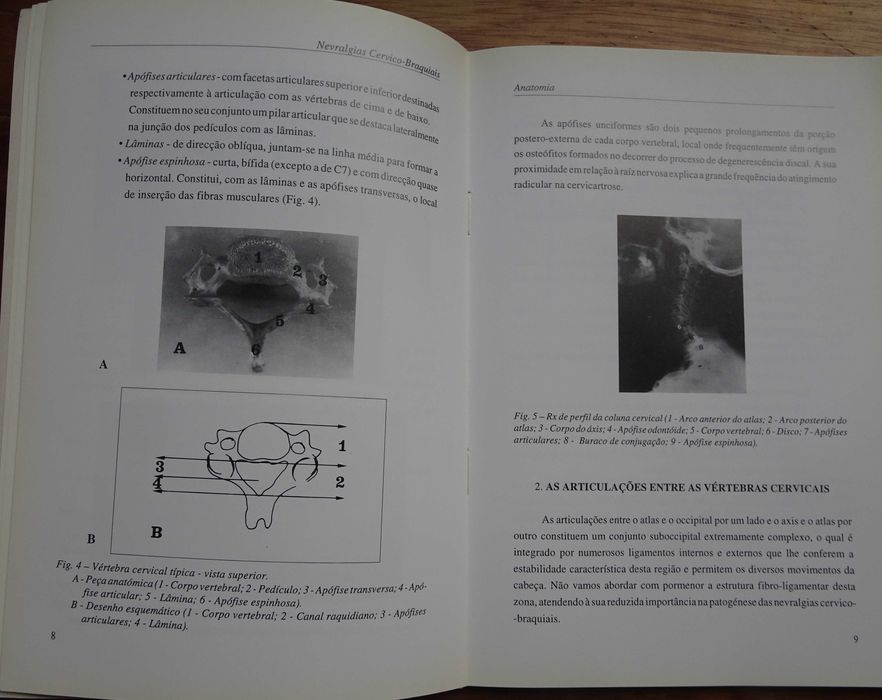 Nevralgias Cervico-Braquiais (Monografia) de Filipe Duarte e Rui Vaz