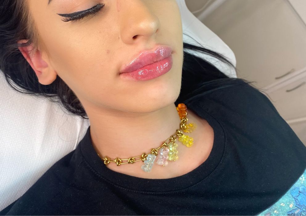 Powiększanie ust, wolumetria, botoks