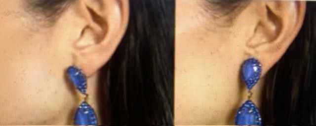 zatyczki do kolczyków  podnoszące - kolczyki