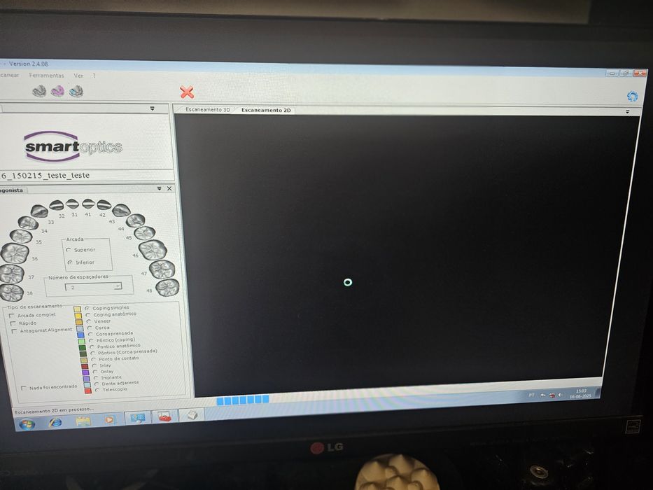 Scanner dentario smartoptics