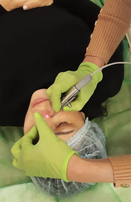 Удаление лазером: геморроя, трещин,полипов, родинок, бородавок и тд.