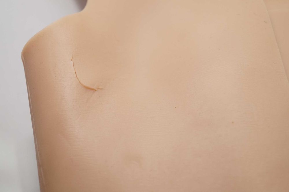 1323 Sztuczne piersi biust cycki silikon r. D mastektomia