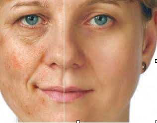 косметична хіджама