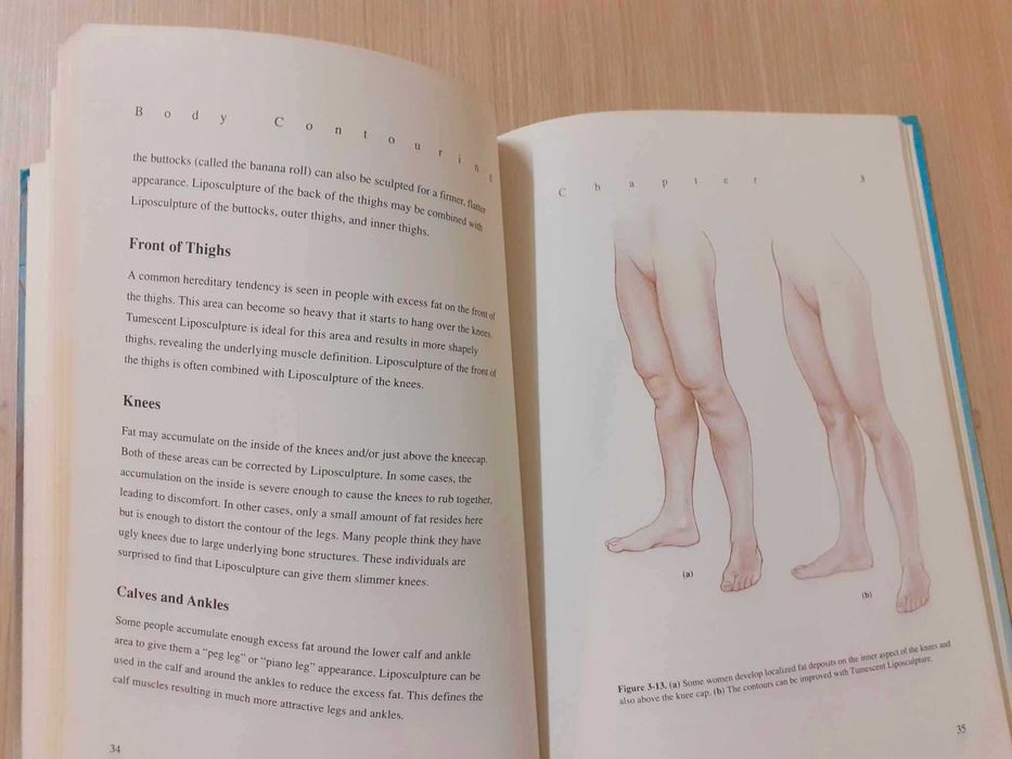 Body Contouring: The New Art of Liposculpture