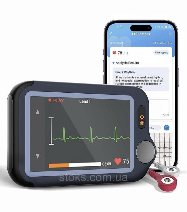 Монитор ЭКГ Wellue