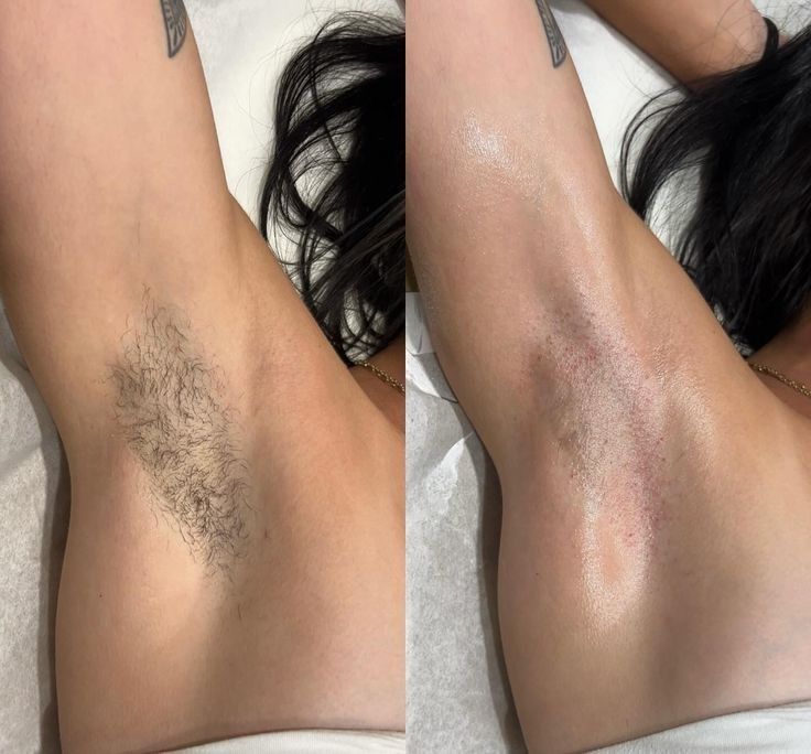 Шугаринг та депіляція воском. м.Запоріжжя, Хортицький район