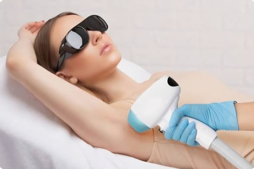 Depilação feminina a laser