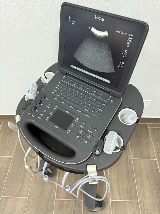 Продам УЗИ аппарат (УЗД апарат) SonoSite Edge ||