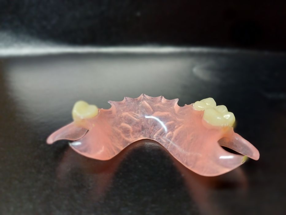 Зубний технік!Співпраця зі стоматологом