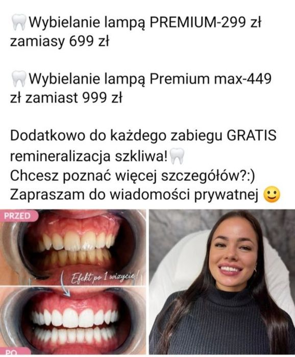 Voucher na Wybielanie zębów