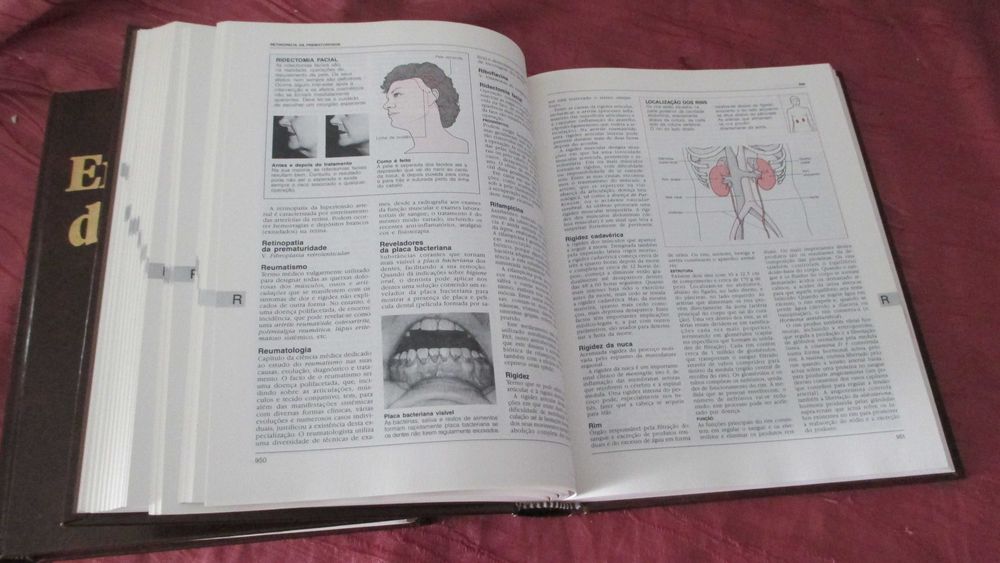Enciclopedia de Medicina ( Colecção 2 Livros A/Z