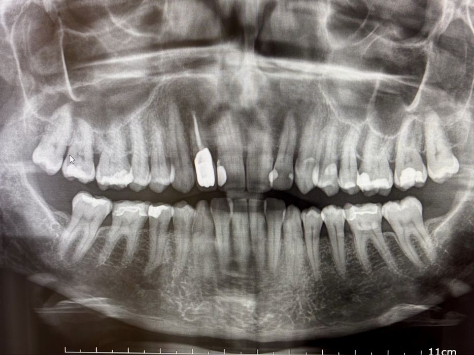 Ortopantomografo Owandy iTouch OPG