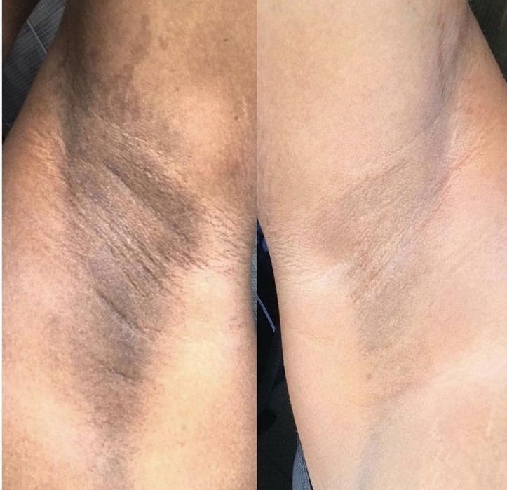 Tratamento natural " PELE E CABELO "