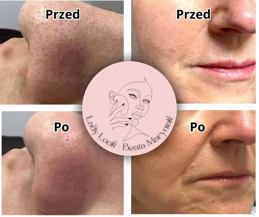 Przedłużanie rzęs, pielęgnacja i kosmetyka twarzy