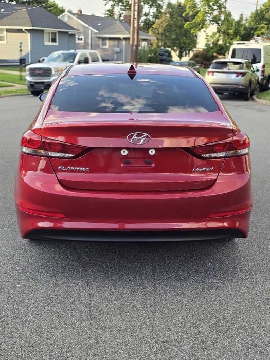 Hyundai Elantra      2017