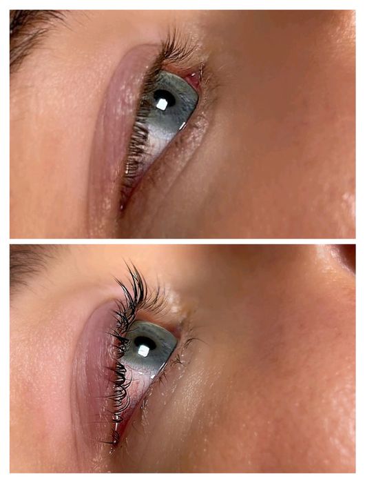 Podkreśl swoje piękno – teraz z 20% rabatem!