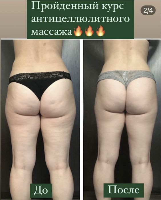 Массаж эпиляция. Только для женщин. Улица Степана Тільгы 34 А