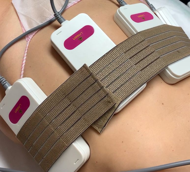 Lipo-laser (Lipolise de Diodo)