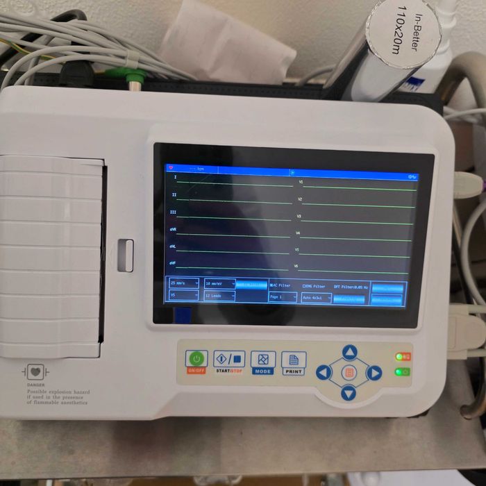 Ecg Contec 600G eletrocardiógrafo