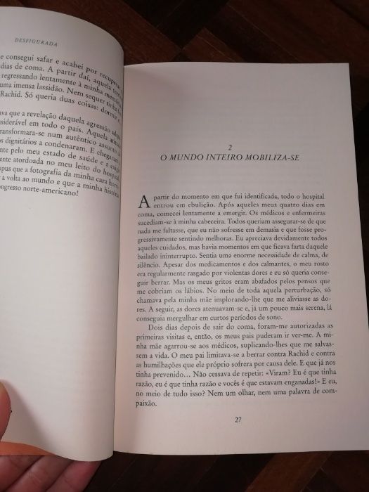 Desfigurada Rania Al-Baz
