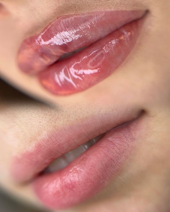 2000 грн будьяка зона!