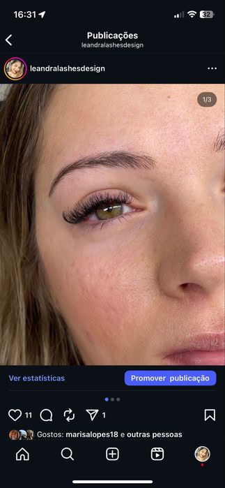 Pestanas e sobrancelhas