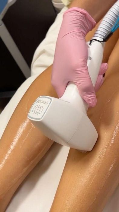 Лазерна епіляція м Херсон