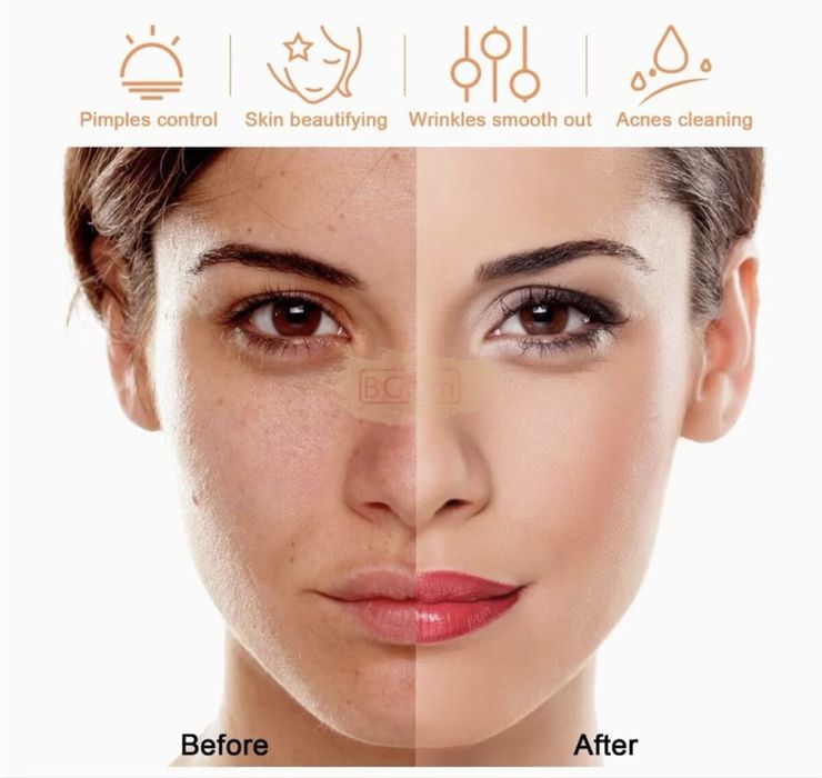 Varinha portátil de terapia facial de alta frequência