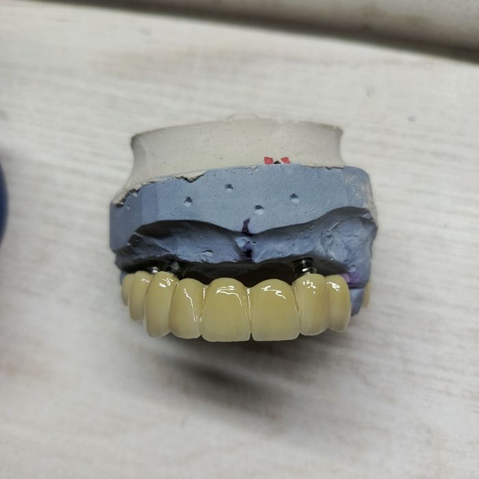 Послуги зубного техніка