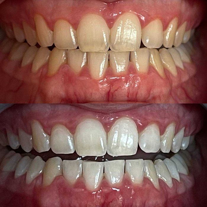 Косметична франшиза/Студія відбілювання зубів Smile LAB