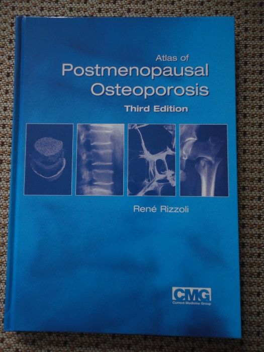 Livro Atlas of Postmenopausal Osteoporosis: Third Edition