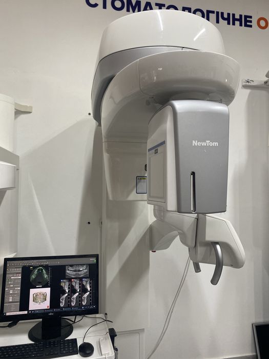 Компʼютерний томограф NewTom Giano