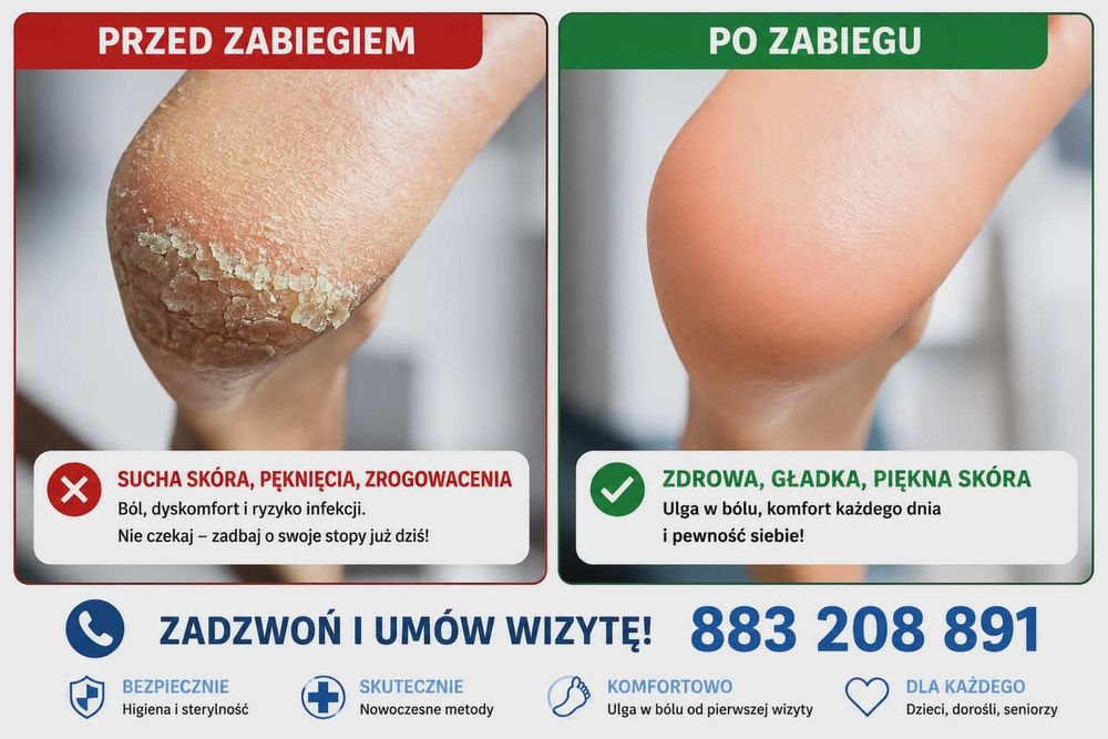 Podolog  mobilny, pedicure , manicure hybrydowy z dojazdem. Poznań. Luboń