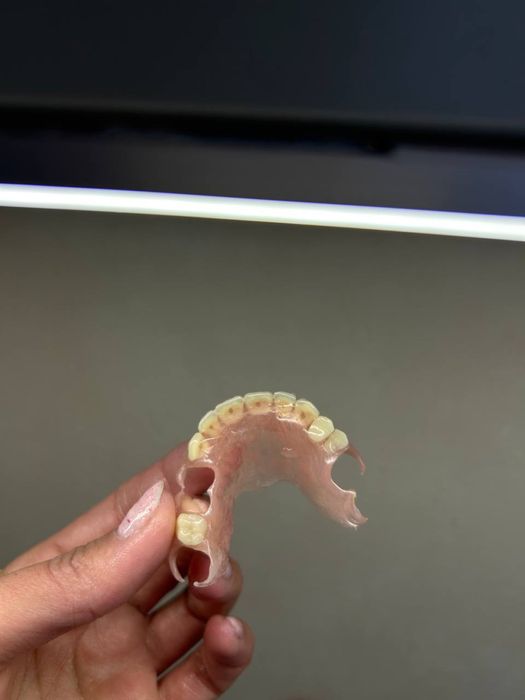 Пресовка інжекція нейлонових