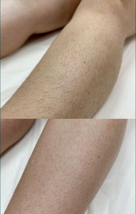 .ЖІНОЧА ВОСКОВА депіляція, Лівий берег. Чернігівська- Лісова. Працюю в