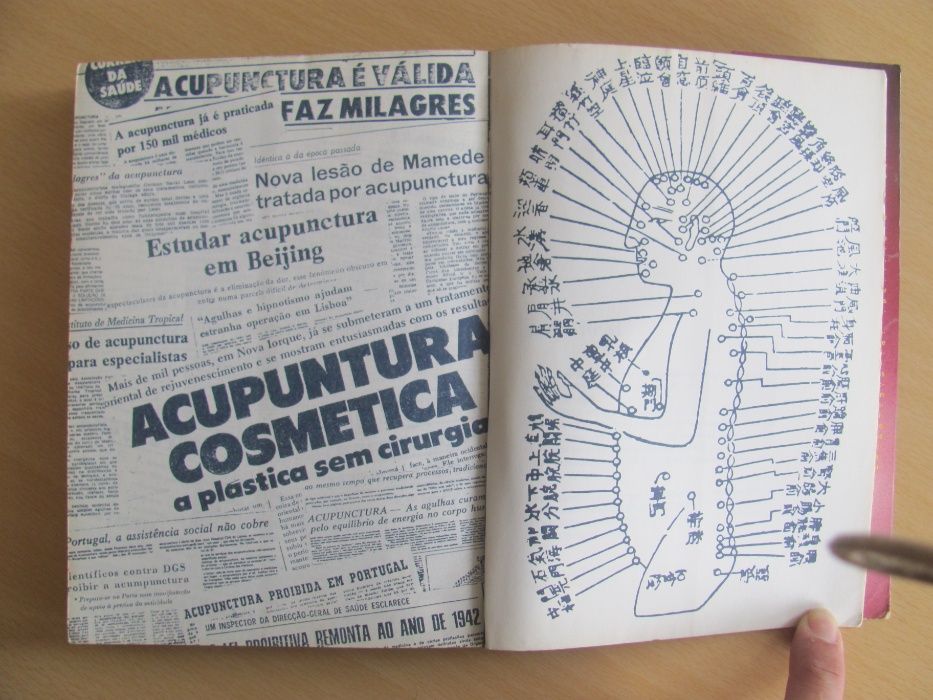 O que deve saber de verdade sobre Acupunctura e não só