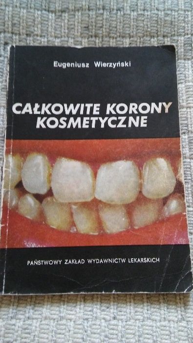 Całkowite korony stomatologiczne Wierzyński stomatologia korony
