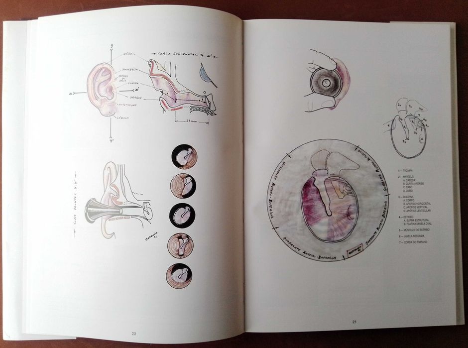 Atlas de Patologia do Ouvido