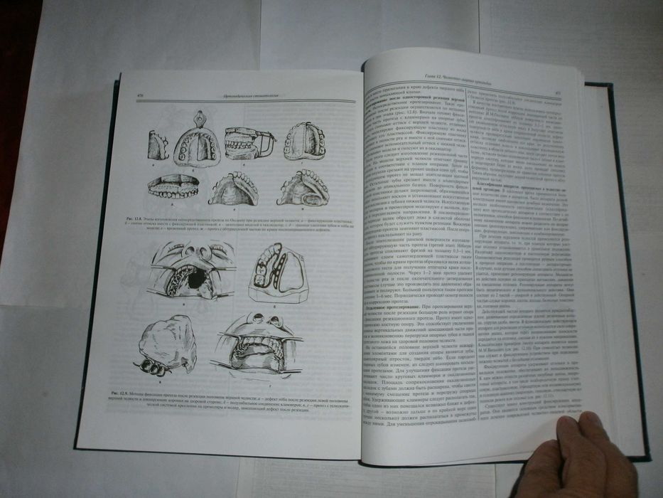 Аболмасов Н.Г.Аболмасов Н.Н  .Ортопедическая стоматология М.2011год