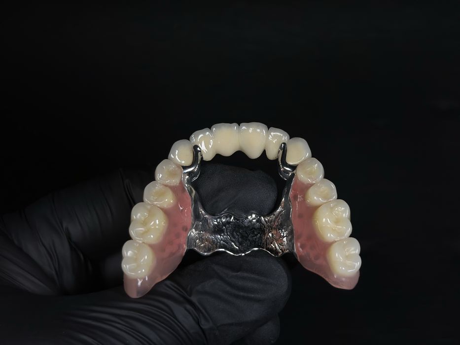 Послуги зубного техніка